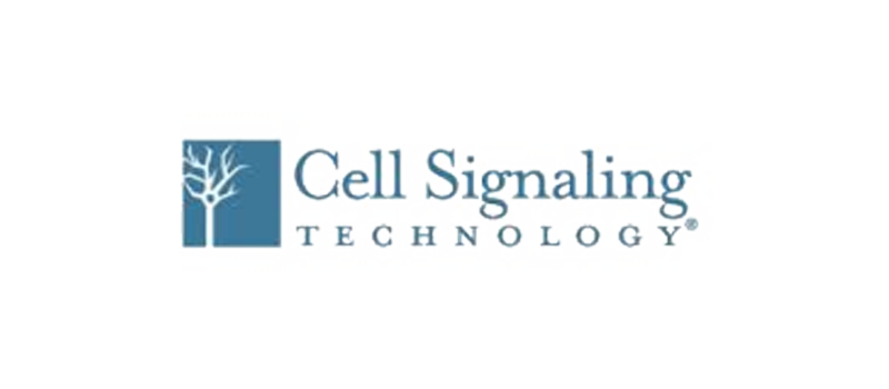 Basigin/EMMPRIN (E1S1V) Rabbit mAb